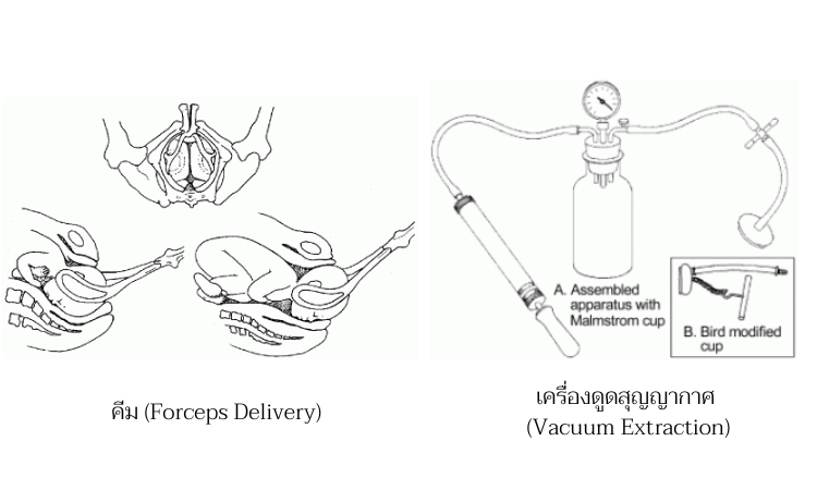 Obstetric Instruments